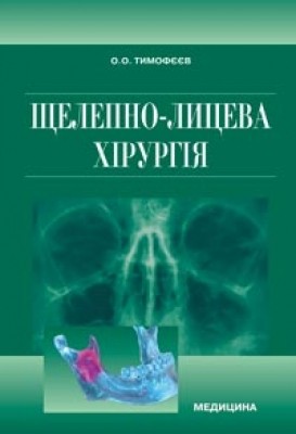 Щелепно-лицева хірургія Підручник НЕМАЄ В НАЯВНОСТІ